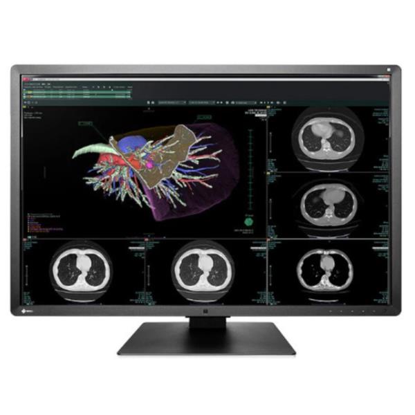 EIZO RadiForce RX660 - Monitor a LED - …